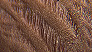 Stretch marks
