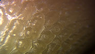 Skin surface pearls
