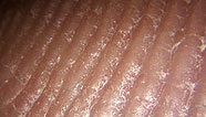Skin surface parallels