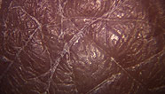 Skin fractal