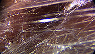 Fibers between muscles