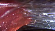 Fibers and muscle