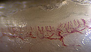 Skin transection and vessels